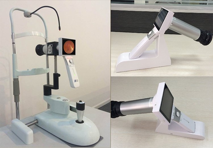 Portable Color Fundus Photography