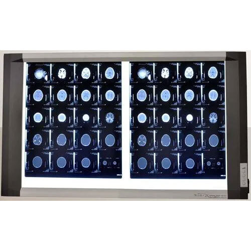 LED X-RAY VIEW BOX DOUBLE FILM