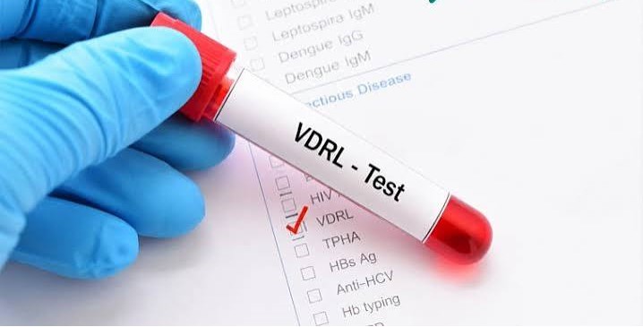 VDRL